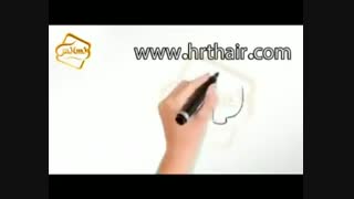 کلیپ انیمیشن پیوند مو و کاشت مو به روش  SUT