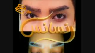 کاشت ابرو طبیعی با روش SUT مرکز کاشت مو زاویه سازی صورت