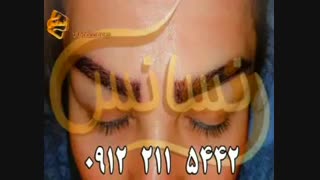 کاشت ابرو طبیعی با روش SUT مرکز کاشت مو ترمیم ونیر