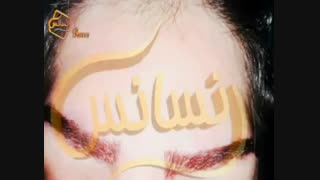 کاشت ابرو طبیعی با روش SUT مرکز کاشت مو لمینت