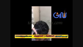 ترمیم مو  کاشت مو روش ترمیم مو های فیکس  آلمان موسسه گلهای تهران