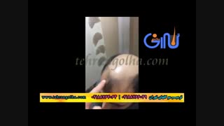 ترمیم مو کاشت مو روش ترمیم مو های فیکس آلمان موسسه ترمیم مو گلهای تهران