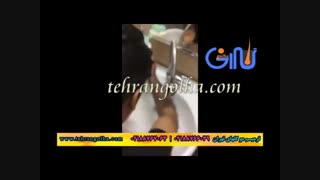 ترمیم مو گلهای تهران - کاشت مو - روش های فیکس آلمان