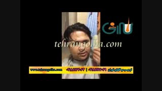 ترمیم مو گلهای تهران - کاشت مو - روش های فیکس آلمان