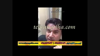 ترمیم مو کاشت مو روش ترمیم مو های فیکس آلمان