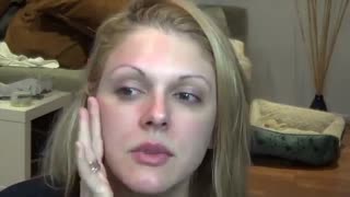 درمارولر DermaRoller - فروش: 09120132883