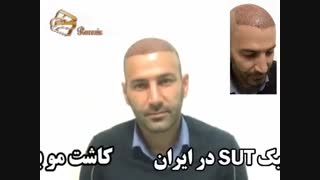 نظرات مراجعین مرکز تخصصی مو رنسانس