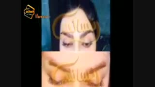 کاشت ابرو طبیعی با روش SUT مرکز کاشت مو