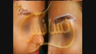 کاشت ابرو طبیعی با روش SUT مرکز کاشت مو