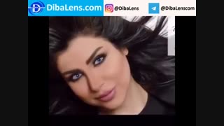 لنزهای رنگی کویین|DibaLens.COM-Queen2