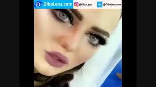 لنز رنگی کویین تیامو|DibaLens.com-Teamo