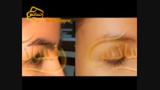 کاشت ابرو طبیعی با روش SUT مرکز کاشت مو