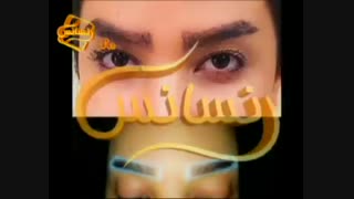 کاشت ابرو طبیعی با روش SUT مرکز کاشت مو