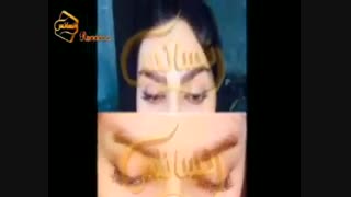 کاشت ابرو طبیعی با روش SUT مرکز کاشت مو