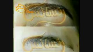 کاشت ابرو طبیعی با روش SUT مرکز کاشت مو