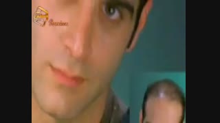 ترمیم مو به روش HRT  مرکز تخصصی مو رنسانس