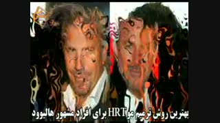 ترمیم مو به روش HRT  مرکز تخصصی مو رنسانس