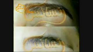 کاشت ابرو طبیعی با روش SUT مرکز کاشت مو