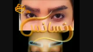 کاشت ابرو طبیعی با روش SUT مرکز کاشت مو