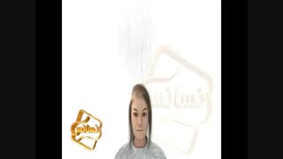 کلیپ انیمیشن پیوند مو و کاشت مو به روش SUT