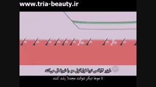 راه حلی دائمی برای معضل موهای زائد (زیرنویس فارسی)