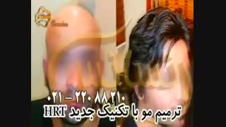 ترمیم مو به روش HRT  مرکز تخصصی مو رنسانس