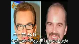 ترمیم مو به روش HRT  مرکز تخصصی مو رنسانس