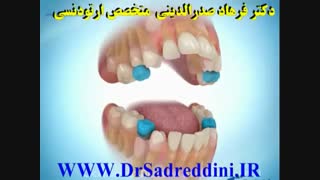 ارتودنسی ارتودنسی