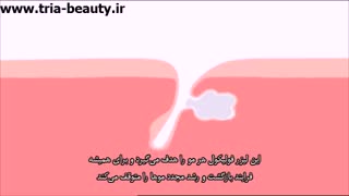 اگر از موهای زائد خود خسته شده اید، این ویدئو را حتما ببینید (زیرنویس فارسی)