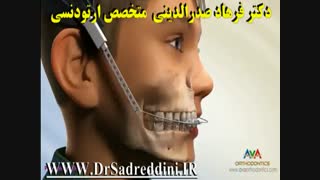 ارتودنسی ترمیم دندان