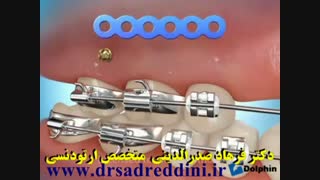 ارتودنسی بررسی لک صورت