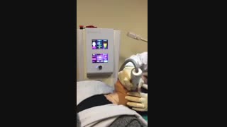 جوانسازی پوست ،لیزر فرکشنال