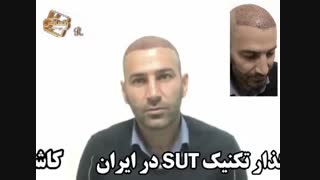 نظرات مراجعین مرکز تخصصی مو رنسانس