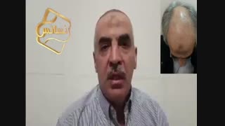 نظرات مراجعین مرکز تخصصی مو رنسانس