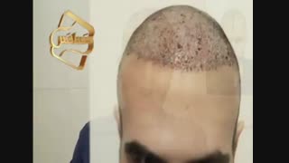 نظرات مراجعین مرکز تخصصی مو رنسانس