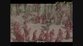 حضرت ابوالفضل ترمیم سوختگی
