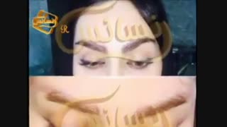 کاشت ابرو طبیعی با روش SUT مرکز کاشت مو