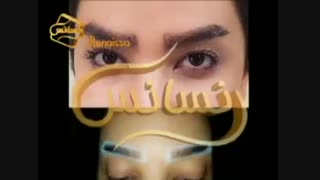 کاشت ابرو طبیعی با روش SUT مرکز کاشت مو