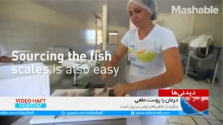 درمان سوختگی با پوست ماهی لیپوساکشن