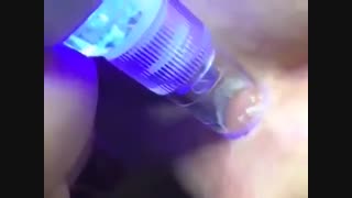 پاکسازی پوست- سالن زیبایی لارا پالپوتومی