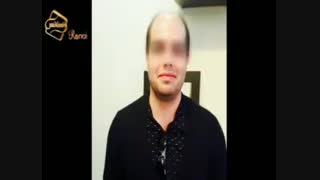 ترمیم مو به روش HRT  مرکز تخصصی مو رنسانس