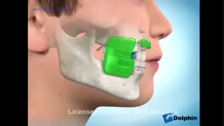 ارتودنسی متحرک