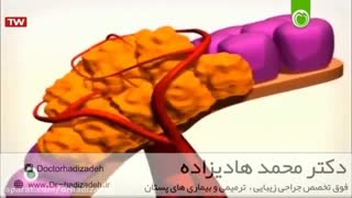 تفاوت سلول طبیعی با سلول سرطانی -