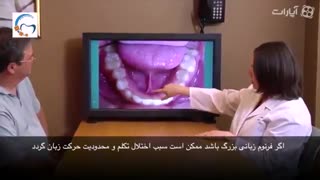 فرنکتومی | دکتر مسعود داودیان ترمیم سوختگی