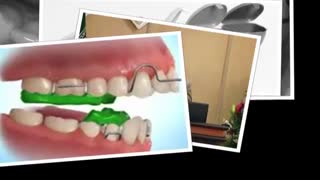 ارتودنسی متحرک | دکتر مسعود داودیان رادیوگرافی دندان