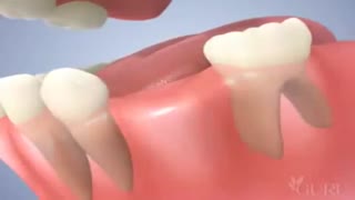 ارتودنسی کودکان | دکتر مسعود داودیان پاکسازی پوست