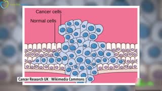 سرطان چیست و چرا هنوز درمان ندارد - فارسی در سیب اول