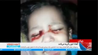 دختر بچه‌ای که خون گریه می‌کند