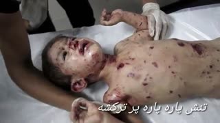 کلیپ بسیار غمگین نسل کشی (با زیر نویس متن شعر) کلیپ رحمان