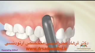 بهترین متخصص ارتودنسی